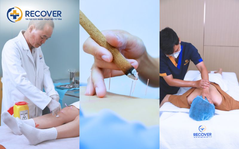 Điều trị Y học cổ truyền