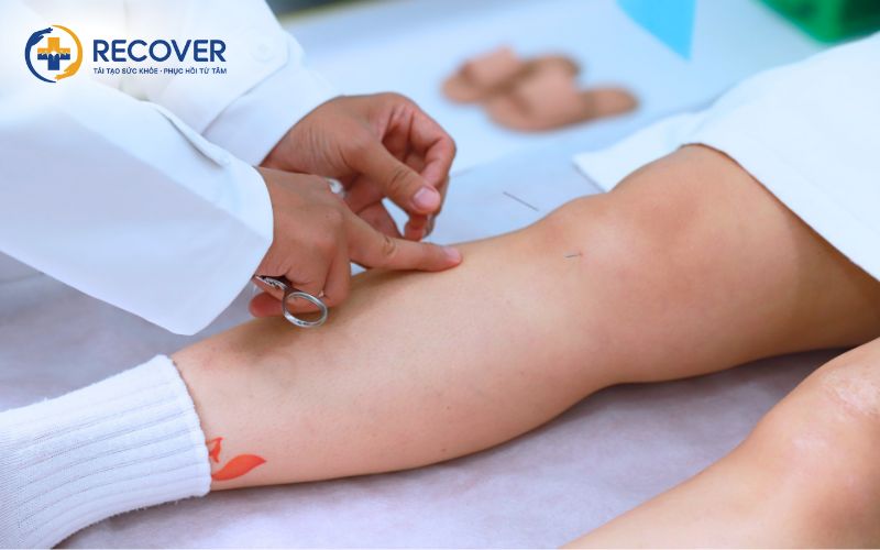Điều trị Y học cổ truyền